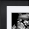 image:imageAmericanflat Sonogram Picture Frame with ShatterResistant Glass  7x7 Ultrasound Frame for 3x4 Sonograms with Interchangeable Mats  Signature Collection  Square Frames for Tabletop and Wall  BlackBlack