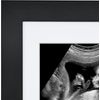 image:imageAmericanflat Sonogram Picture Frame with ShatterResistant Glass  7x7 Ultrasound Frame for 3x4 Sonograms with Interchangeable Mats  Signature Collection  Square Frames for Tabletop and Wall  BlackBlack